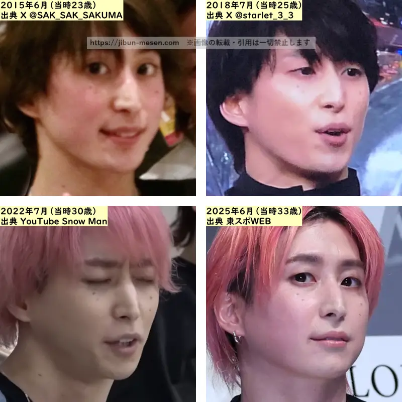 佐久間大介の鼻の整形検証2015年~2025年の画像