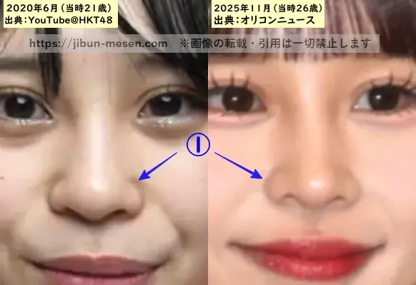 村川緋杏の鼻の整形検証2020年~2025年(拡大)の画像