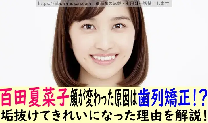 百田夏菜子顔が変わった理由は歯列矯正！？ 垢ぬけてきれいになった理由を解説！