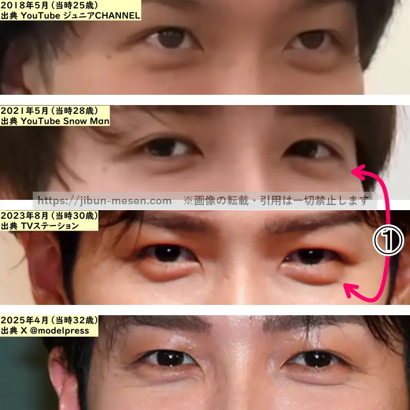 渡辺翔太の目の整形検証2018年～2025年（拡大）の画像