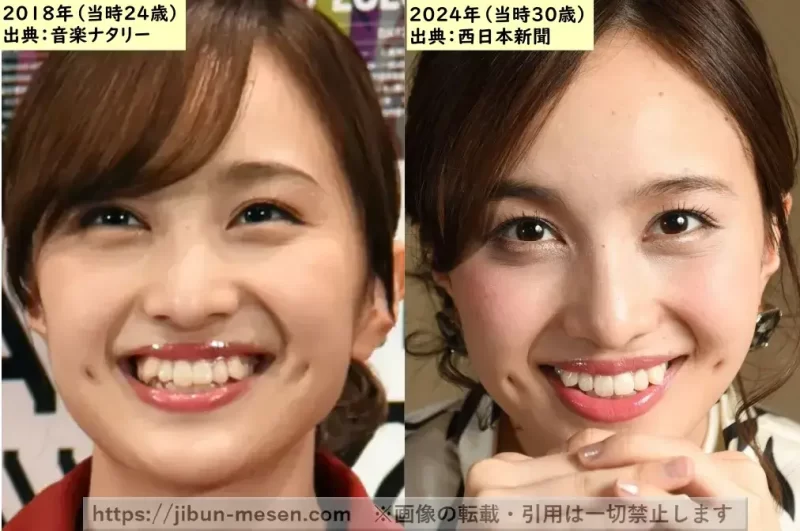 【左】20代【右】30代の百田夏菜子の画像