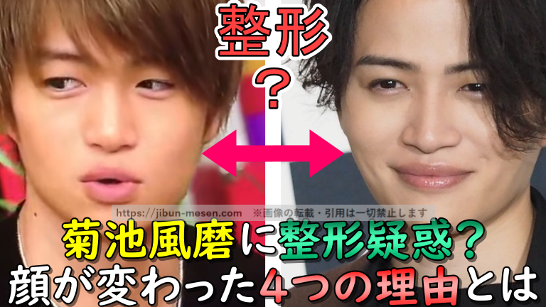 菊池風磨に整形疑惑？顔が変わった４つの理由とは？