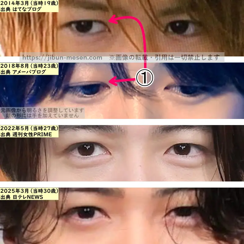 菊池風磨の目の整形検証2014年～2025年の画像