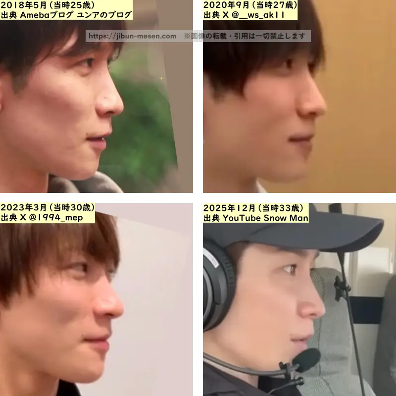 渡辺翔太の鼻の整形検証2018年～2025年（横顔）の画像