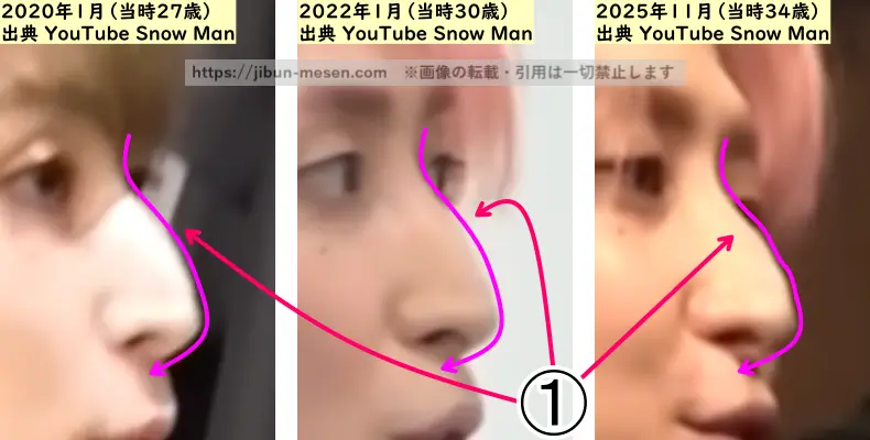 佐久間大介の鼻の整形検証2020年~2025年(横顔・拡大)の画像