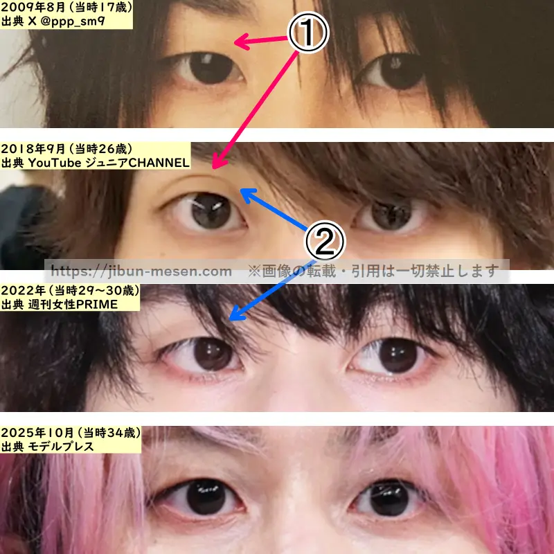 佐久間大介の目の整形検証2009年~2025年(拡大)の画像