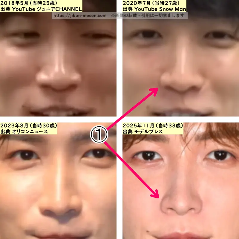 渡辺翔太の鼻の整形検証2018年～2025年（拡大）の画像