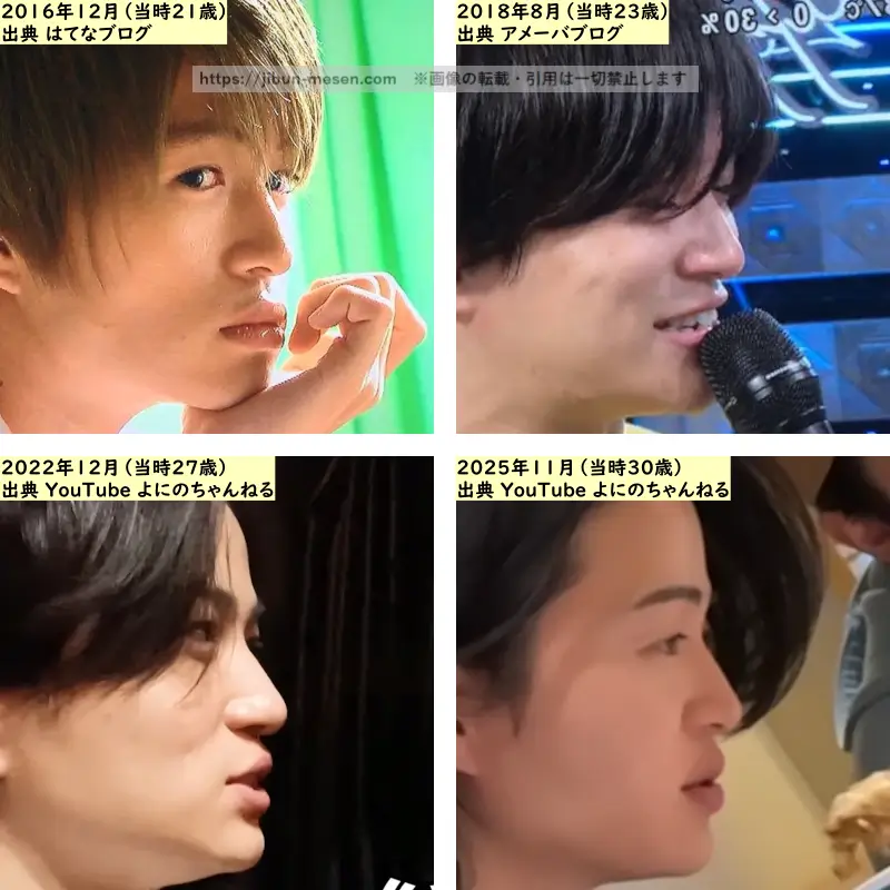 菊池風磨の鼻の整形検証2016年～2025年（横顔）の画像