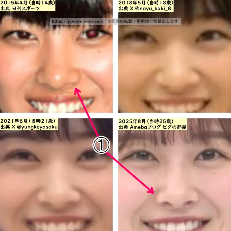 原田葵の鼻の整形検証2015年～2025年（拡大）の画像