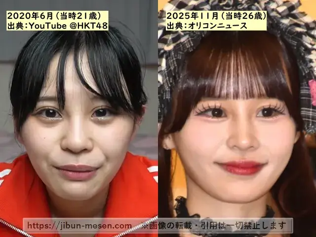 村川緋杏の鼻の整形検証2020年~2025年の画像