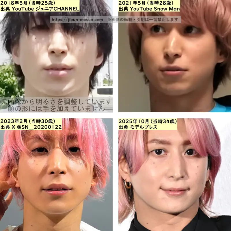 佐久間大介の唇の整形検証2018年~2025年の画像