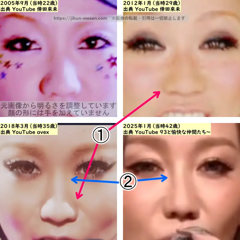 倖田來未の鼻の整形検証2005年～2025年（拡大）の画像