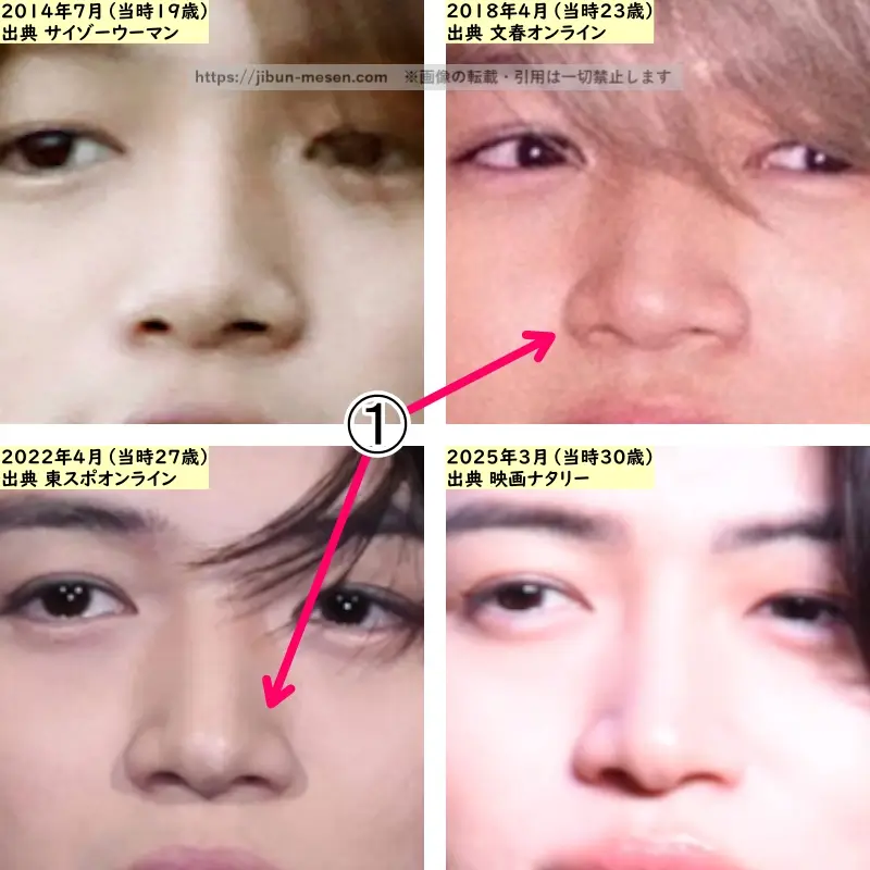菊池風磨の鼻の整形検証2014年～2025年（拡大）の画像
