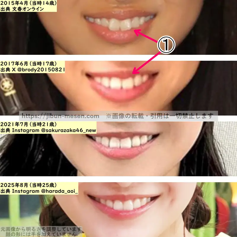 原田葵の唇の整形検証2015年～2025年（拡大）の画像