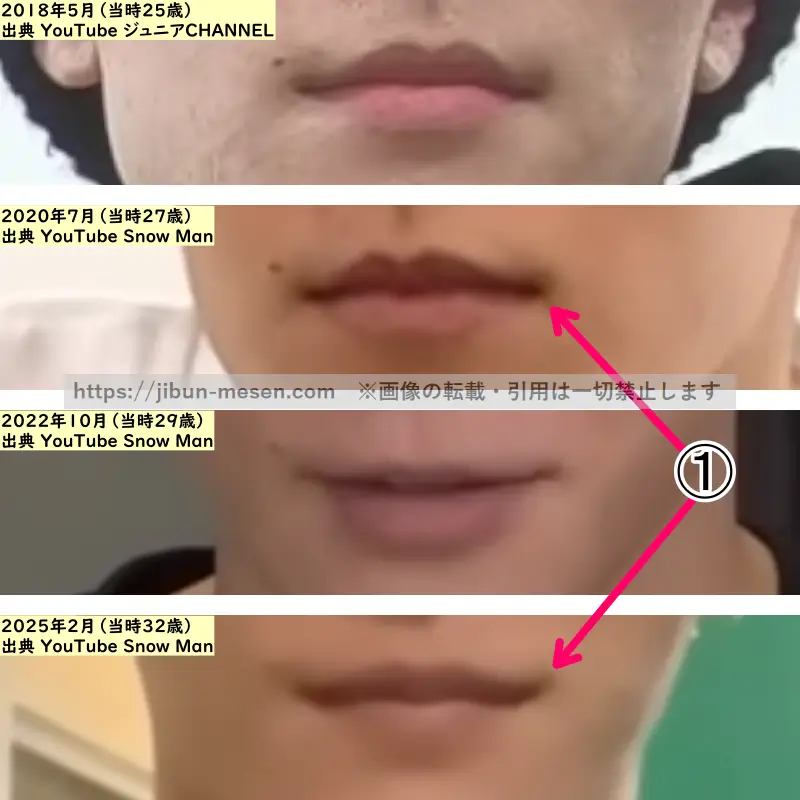 渡辺翔太の唇の整形検証2018年～2025年（拡大）の画像