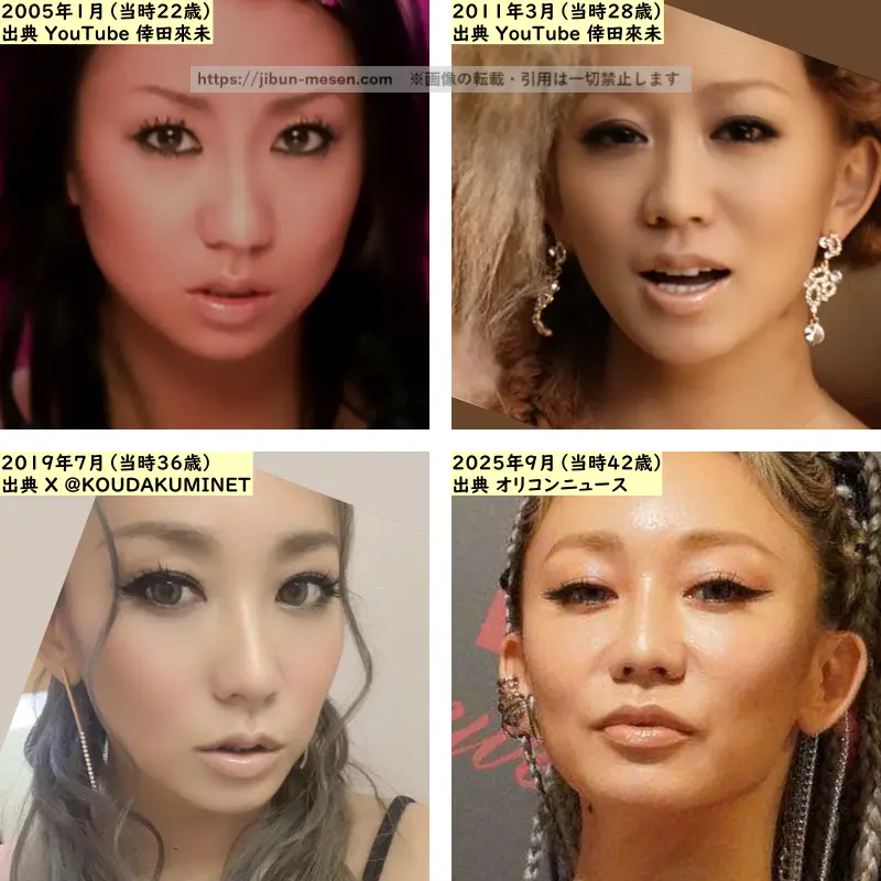 倖田來未の目の整形検証2005年～2025年の画像