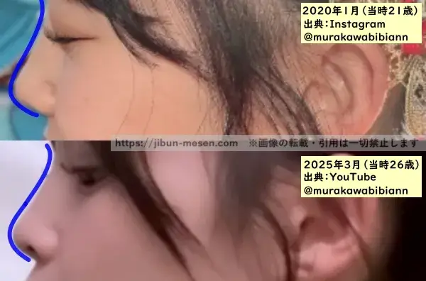 村川緋杏の鼻の整形検証2020年~2025年(横顔拡大)の画像