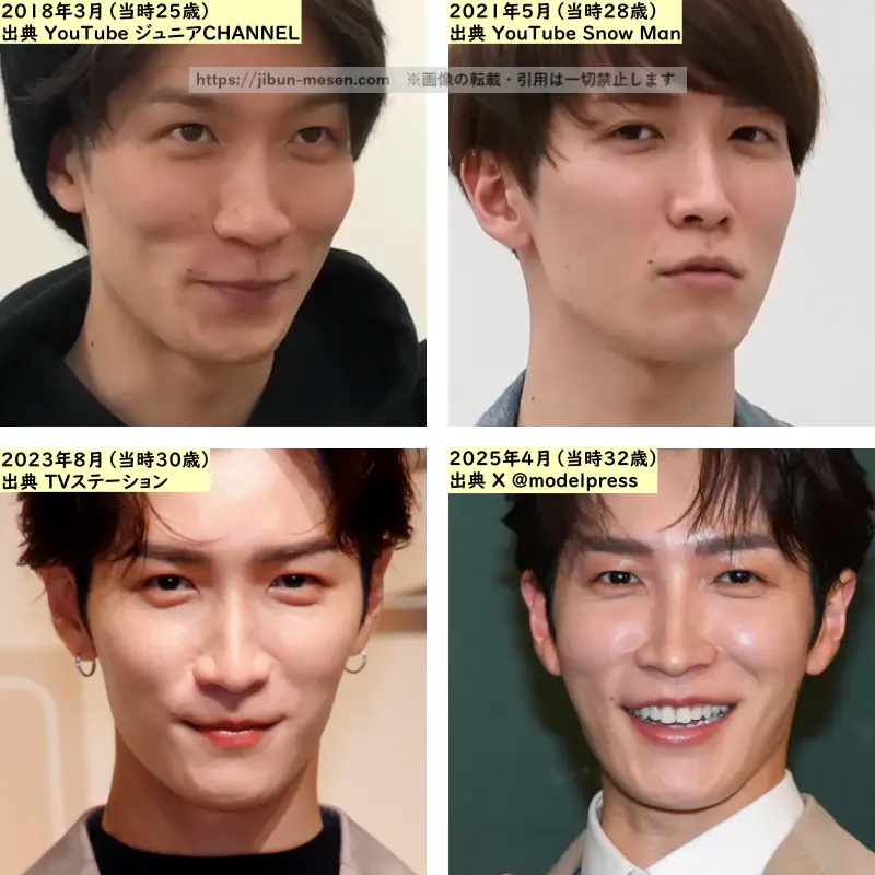 渡辺翔太の目の整形検証2018年～2025年の画像