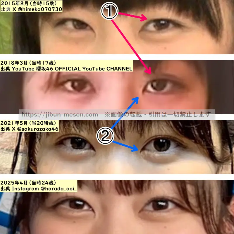 原田葵の目の整形検証2015年～2025年（拡大）の画像