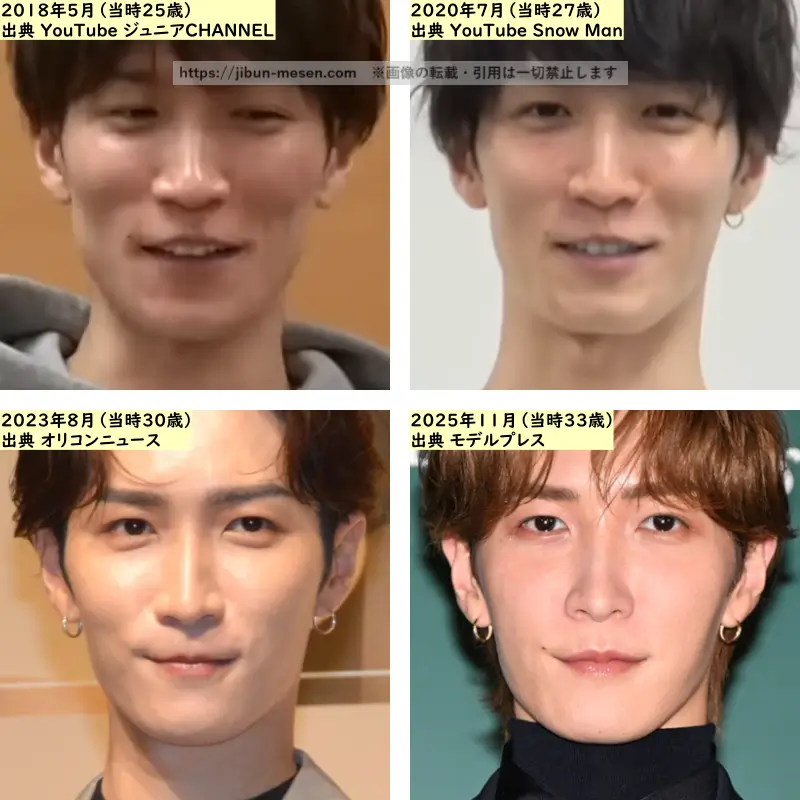 渡辺翔太の鼻の整形検証2018年～2025年の画像