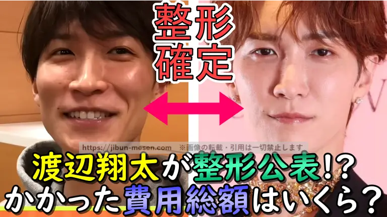 渡辺翔太が整形公表！？ かかった総額費用はいくら？