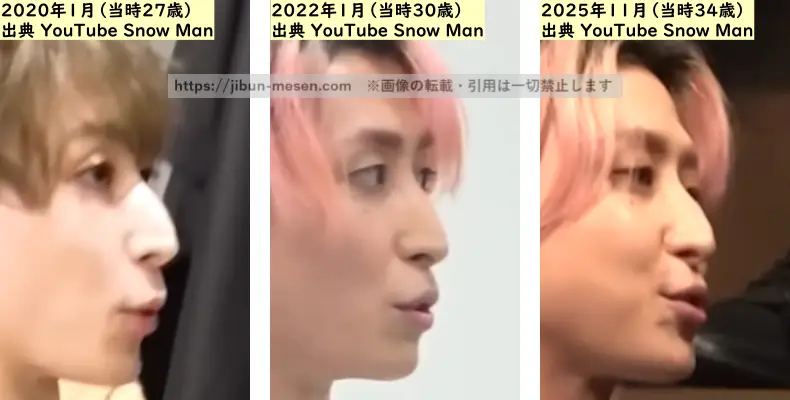 佐久間大介の鼻の整形検証2020年~2025年(横顔)の画像