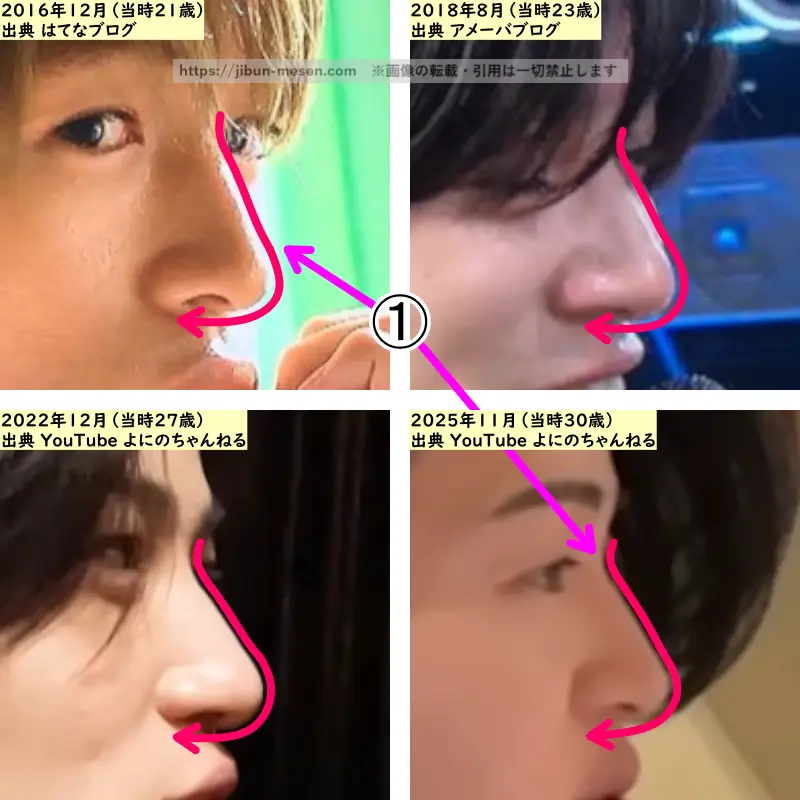 菊池風磨の鼻の整形検証2016年～2025年（横顔・拡大）の画像