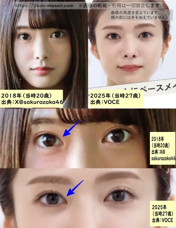 田村保乃の目の整形検証2018年～2025年の画像