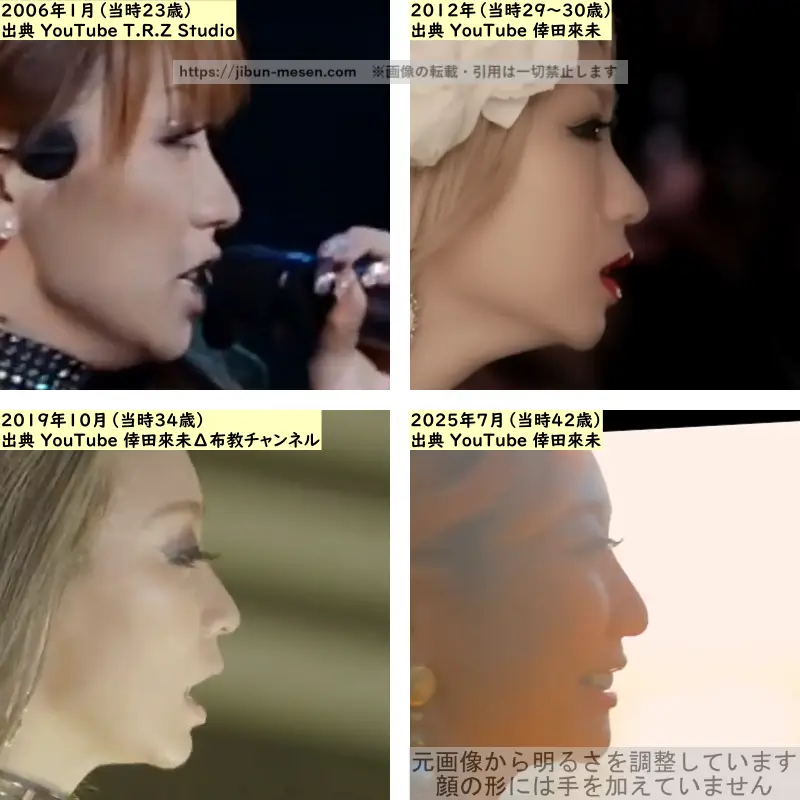 倖田來未の鼻の整形検証2006年～2025年（横顔）の画像