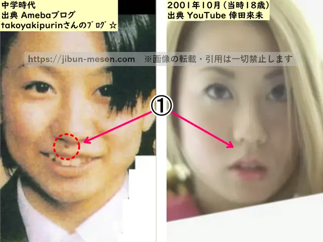 倖田來未のホクロの整形検証中学時代～2001年の画像