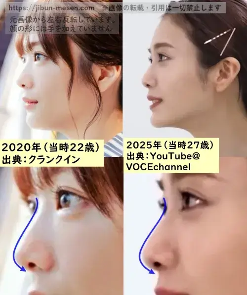田村保乃の鼻の整形検証2019年～2025年（横顔）の画像