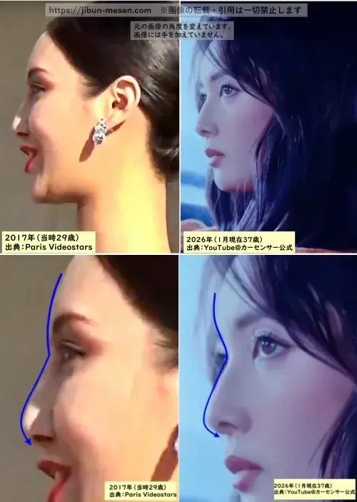 菜々緒の鼻の整形検証2017年～2026年の画像