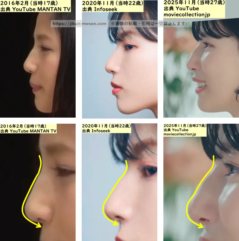 石井杏奈の鼻の整形検証2016年~2025年の画像