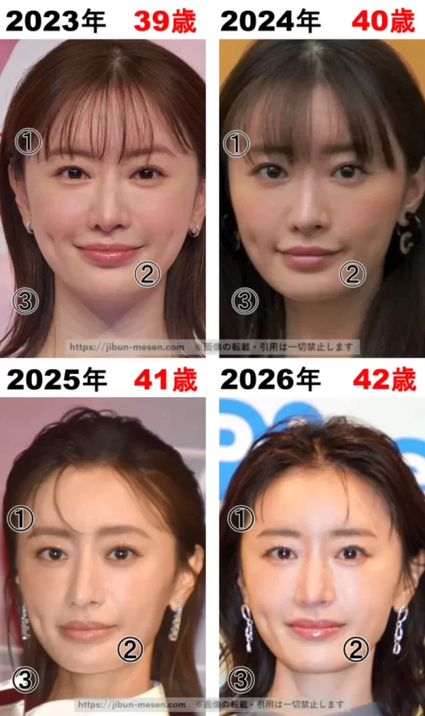 松本まりかの整形検証2023年～2026年の画像