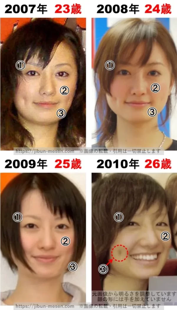 松本まりかの整形検証2007年～2010年の画像