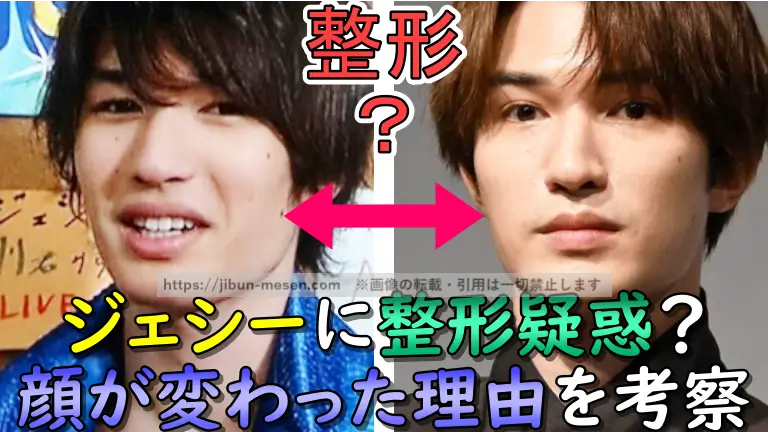 ジェシーに整形疑惑？顔が変わった理由を考察