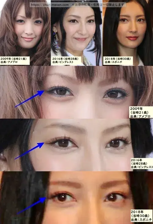 菜々緒の目の整形検証2009年～2018年の画像