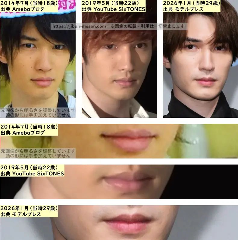 ジェシーの唇の整形検証2014年~2025年の画像