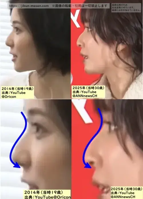 松岡茉優の鼻の整形検証(横顔)2014年~2025年の画像