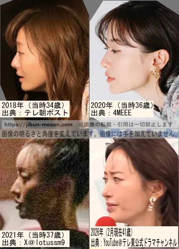 松本まりかのおでこの整形検証2018年～2026年の画像