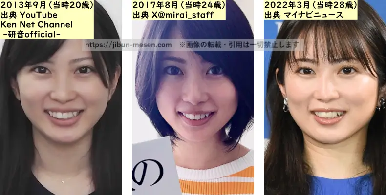 志田未来の顔の整形検証2013年～2022年の画像