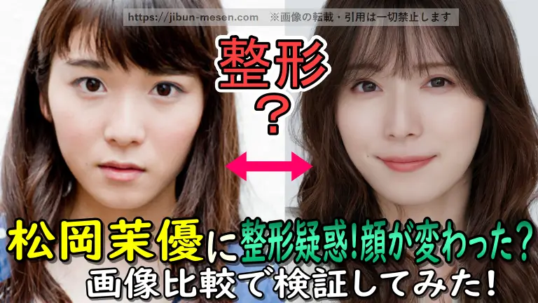 松岡茉優に整形疑惑！顔が変わった？