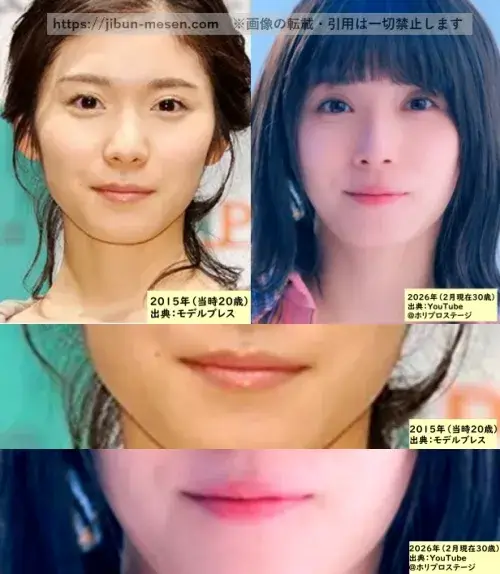 松岡茉優の唇の整形検証2015年~2026年の画像