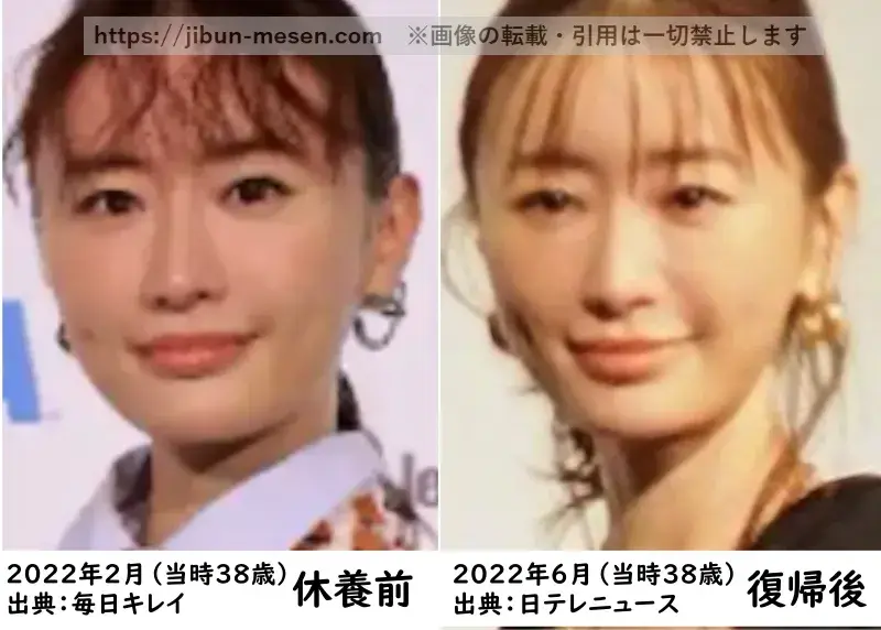 【左】休養前と【右】復帰後の松本まりかの画像