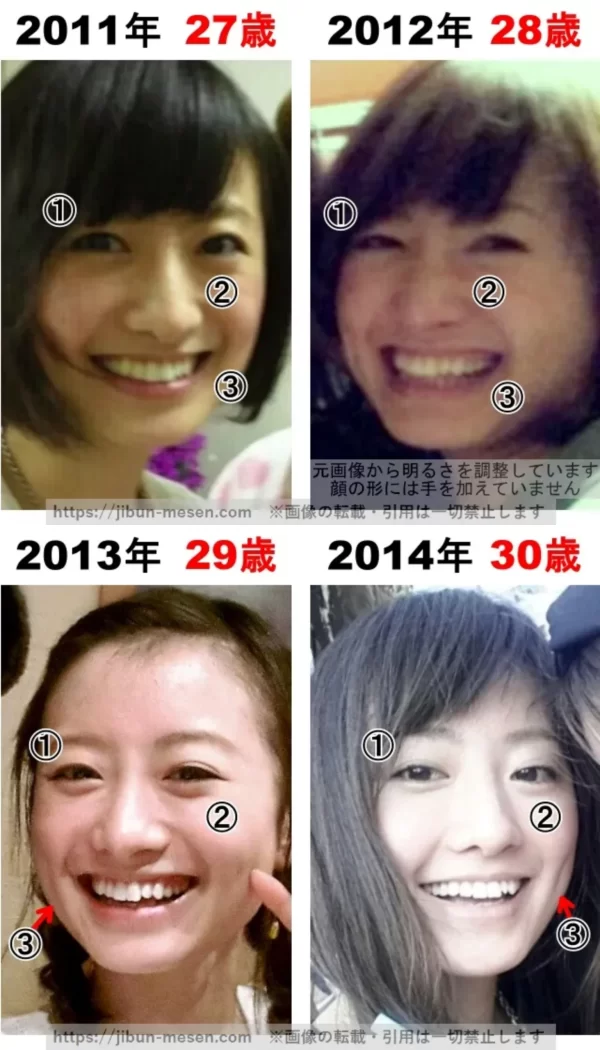 松本まりかの整形検証2011年～2014年の画像