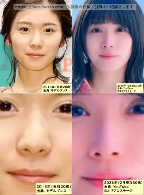松岡茉優の鼻の整形検証2015年~2026年の画像