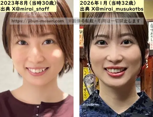 志田未来の顔の整形検証2023年～2026年の画像