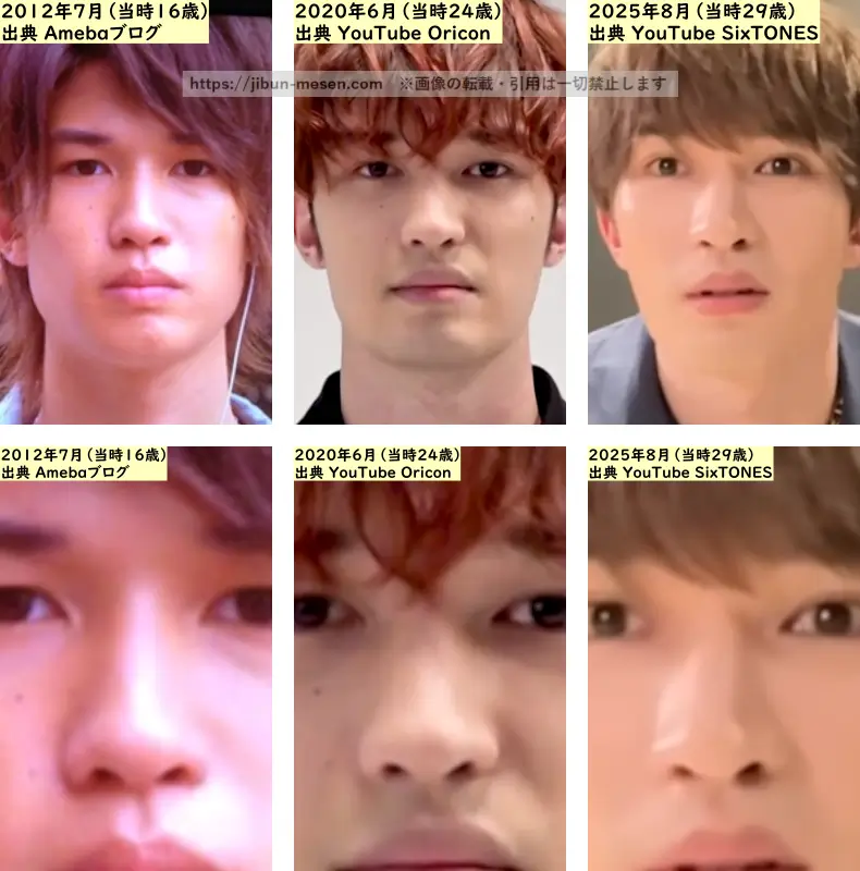 ジェシーの鼻の整形検証2012年~2025年の画像