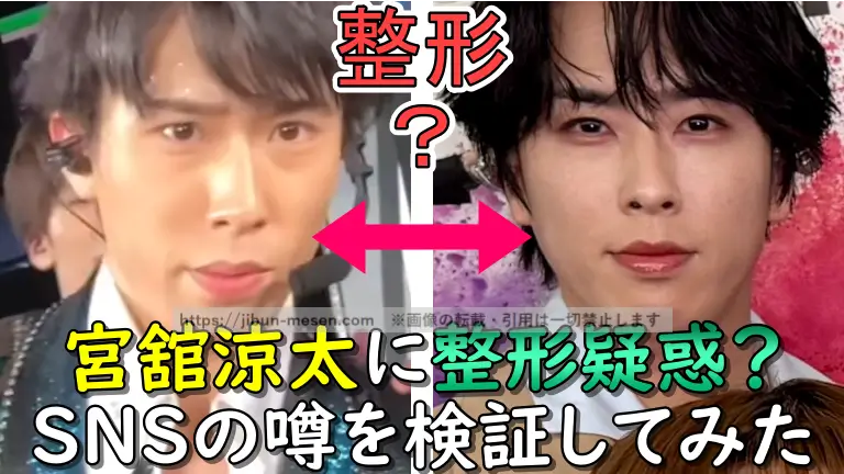 宮舘涼太に整形疑惑？ SNSの噂を検証してみた