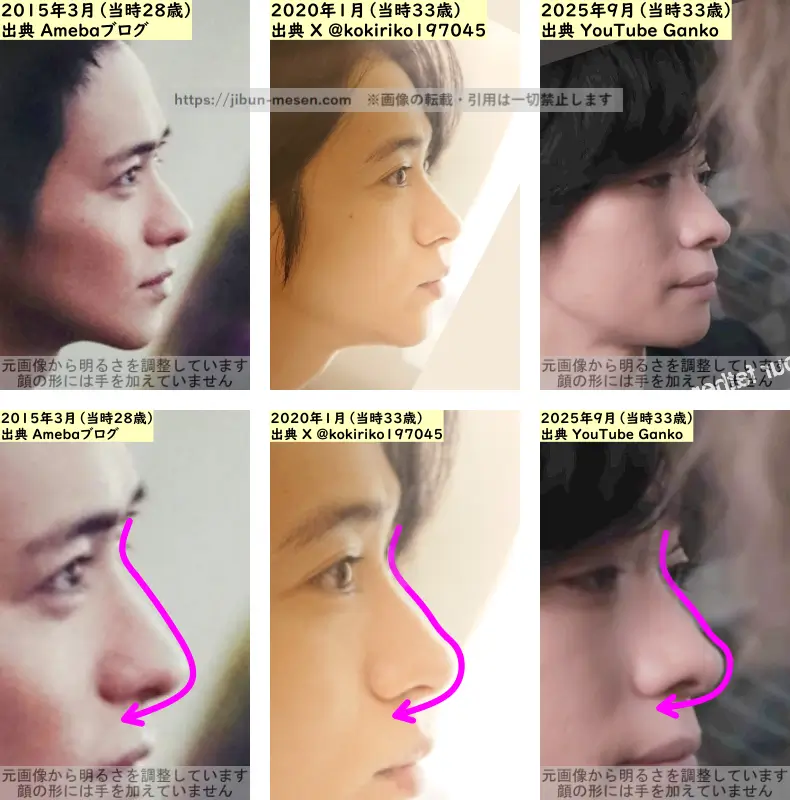 戸塚祥太の鼻の整形検証2015年～2025年（横顔）の画像